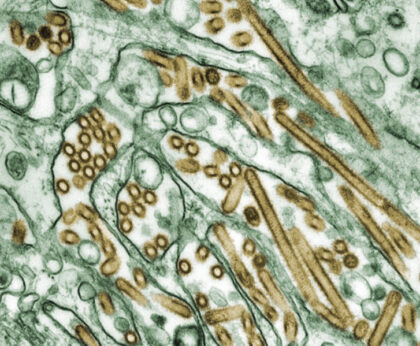 Il virus H5N1. Photo Credit: Cynthia Goldsmith Content Providers: CDC/ Courtesy of Cynthia Goldsmith; Jacqueline Katz; Sherif R. Zaki