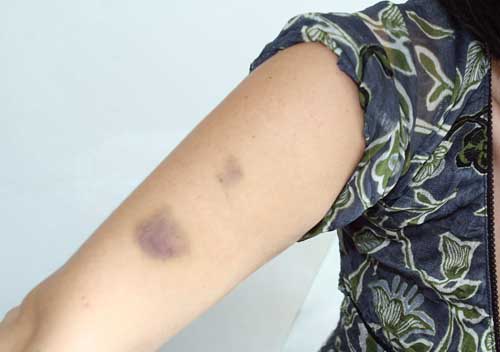 Ritratta sullo stupro. L’ex condannato per stalking