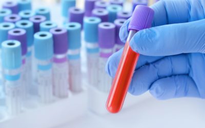 Le analisi del sangue andrebbero fatte più spesso