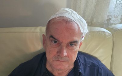 Ferito alla testa col piede di porco dai ladri, paura per professore di Unife